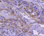 IRF5 Antibody in Immunohistochemistry (Paraffin) (IHC (P))