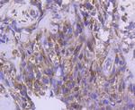 IRF5 Antibody in Immunohistochemistry (Paraffin) (IHC (P))