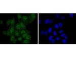 PAX5 Antibody in Immunocytochemistry (ICC/IF)