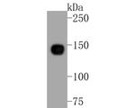 ITGA5 Antibody in Western Blot (WB)