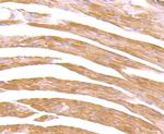 CXCR5 Antibody in Immunohistochemistry (Paraffin) (IHC (P))