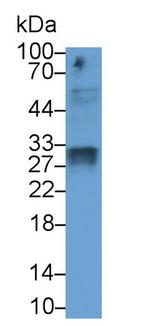 SOD3 Antibody in Western Blot (WB)