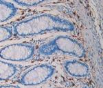 Tryptase Antibody in Immunohistochemistry (Paraffin) (IHC (P))