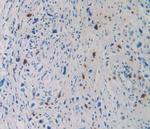 Tryptase Antibody in Immunohistochemistry (Paraffin) (IHC (P))