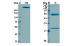 Visilizumab Humanized Antibody in SDS-PAGE (SDS-PAGE)