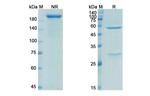 Ecromeximab Chimeric Antibody in SDS-PAGE (SDS-PAGE)