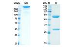 Abituzumab Humanized Antibody in SDS-PAGE (SDS-PAGE)