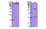 Depatuxizumab Chimeric Antibody in SDS-PAGE (SDS-PAGE)