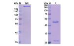 Gatipotuzumab Humanized Antibody in SDS-PAGE (SDS-PAGE)