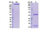 Leronlimab Humanized Antibody in SDS-PAGE (SDS-PAGE)