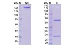 Samrotamab Chimeric Antibody in SDS-PAGE (SDS-PAGE)