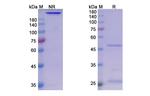 Sasanlimab Humanized Antibody in SDS-PAGE (SDS-PAGE)