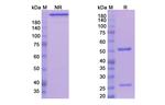 Teplizumab Humanized Antibody in SDS-PAGE (SDS-PAGE)