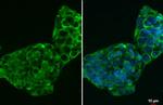 CTGF Antibody in Immunocytochemistry (ICC/IF)