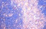 CTGF Antibody in Immunohistochemistry (Paraffin) (IHC (P))