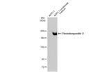 Thrombospondin 2 Antibody in Western Blot (WB)