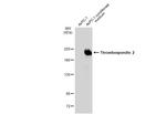 Thrombospondin 2 Antibody in Western Blot (WB)