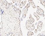 MSH6 Antibody in Immunohistochemistry (Paraffin) (IHC (P))