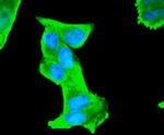 S100B Antibody in Immunocytochemistry (ICC/IF)