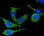 PYK2 Antibody in Immunocytochemistry (ICC/IF)