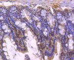 STAT5 beta Antibody in Immunohistochemistry (Paraffin) (IHC (P))