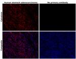 Calretinin Antibody in Immunohistochemistry (Paraffin) (IHC (P))