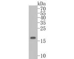 UBE2B Antibody in Western Blot (WB)