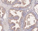 NSUN4 Antibody in Immunohistochemistry (Paraffin) (IHC (P))