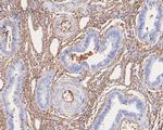 A2M Antibody in Immunohistochemistry (Paraffin) (IHC (P))