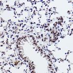 SNRPA1 Antibody in Immunohistochemistry (Paraffin) (IHC (P))