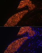 Hemoglobin gamma-1 Antibody in Immunohistochemistry (Paraffin) (IHC (P))