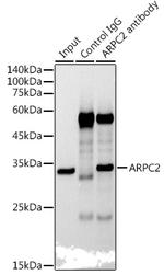 ARPC2 Antibody in Immunoprecipitation (IP)