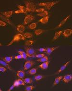 Versican Antibody in Immunocytochemistry (ICC/IF)