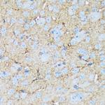 Versican Antibody in Immunohistochemistry (Paraffin) (IHC (P))