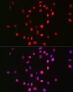 H3K18me1 Antibody in Immunocytochemistry (ICC/IF)