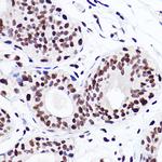 H3K18me1 Antibody in Immunohistochemistry (Paraffin) (IHC (P))