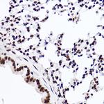 H3K18me1 Antibody in Immunohistochemistry (Paraffin) (IHC (P))