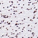 H3K18me1 Antibody in Immunohistochemistry (Paraffin) (IHC (P))