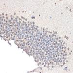 RCOR1 Antibody in Immunohistochemistry (Paraffin) (IHC (P))