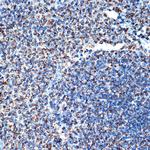 CD264 (TRAIL-R4) Antibody in Immunohistochemistry (Paraffin) (IHC (P))