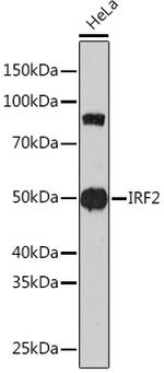 IRF2 Antibody in Western Blot (WB)