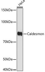 Caldesmon Antibody in Western Blot (WB)