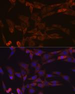 Activin A Antibody in Immunocytochemistry (ICC/IF)