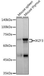 IKZF3 Recombinant Monoclonal Antibody (4U7F9) (MA5-42889)