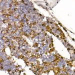 Neutrophil elastase Antibody in Immunohistochemistry (Paraffin) (IHC (P))