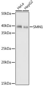 SMN1 Antibody in Western Blot (WB)