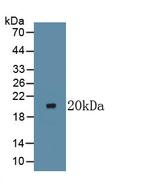 LTBR Antibody in Western Blot (WB)