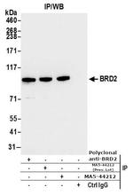 BRD2 Antibody in Immunoprecipitation (IP)