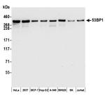 53BP1 Antibody in Western Blot (WB)