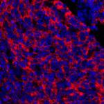 CD73 Antibody in Immunohistochemistry (Paraffin) (IHC (P))